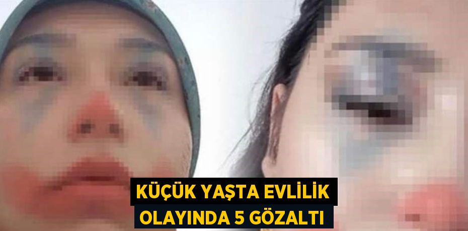 KÜÇÜK YAŞTA EVLİLİK OLAYINDA 5 GÖZALTI