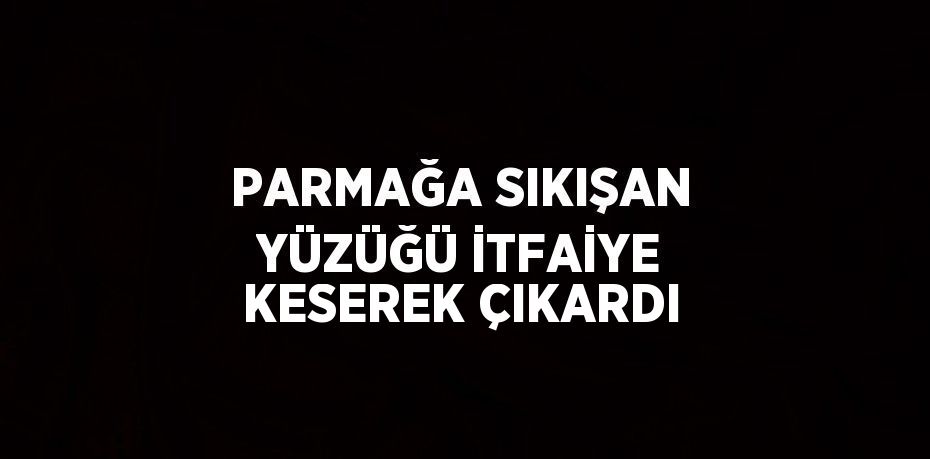 PARMAĞA SIKIŞAN YÜZÜĞÜ İTFAİYE KESEREK ÇIKARDI