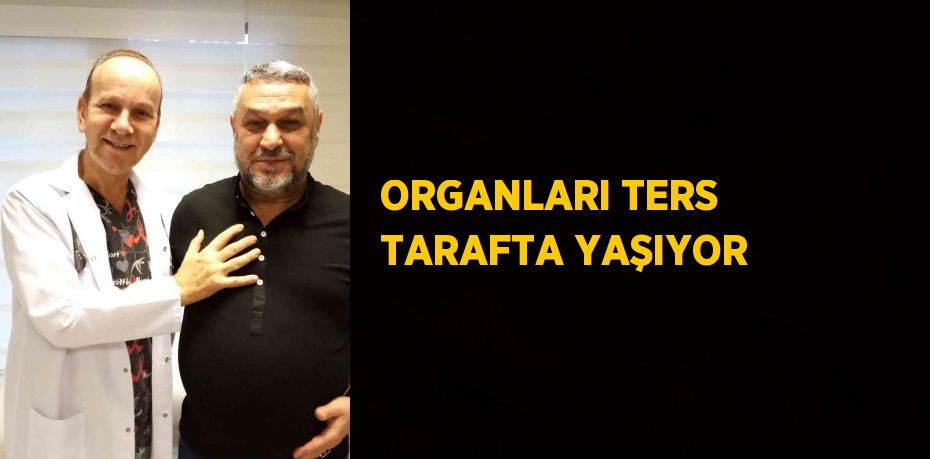 ORGANLARI TERS TARAFTA YAŞIYOR