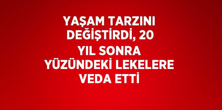 YAŞAM TARZINI DEĞİŞTİRDİ, 20 YIL SONRA YÜZÜNDEKİ LEKELERE VEDA ETTİ