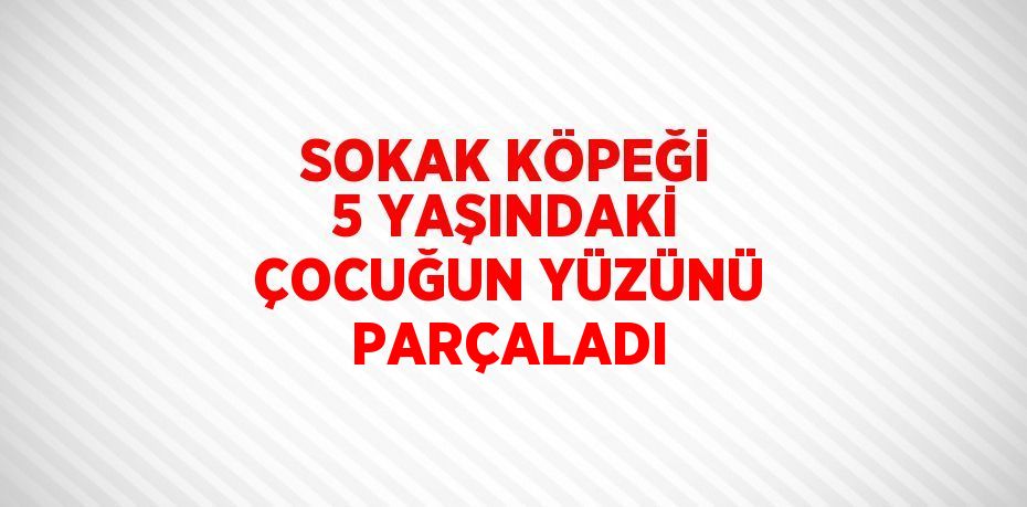 SOKAK KÖPEĞİ 5 YAŞINDAKİ ÇOCUĞUN YÜZÜNÜ PARÇALADI