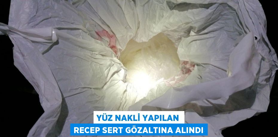 YÜZ NAKLİ YAPILAN RECEP SERT GÖZALTINA ALINDI