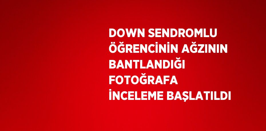 DOWN SENDROMLU ÖĞRENCİNİN AĞZININ BANTLANDIĞI FOTOĞRAFA İNCELEME BAŞLATILDI