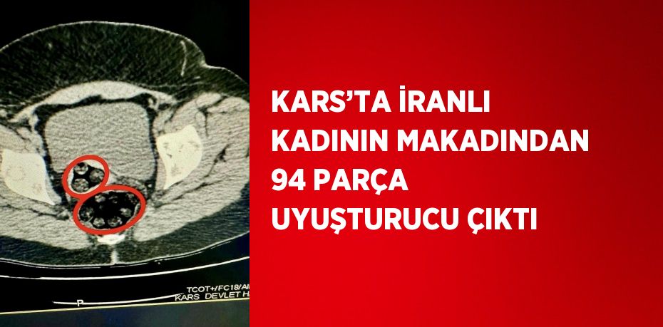 KARS’TA İRANLI KADININ MAKADINDAN 94 PARÇA UYUŞTURUCU ÇIKTI