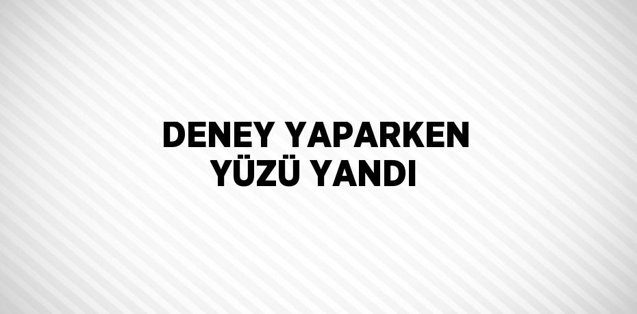 DENEY YAPARKEN YÜZÜ YANDI