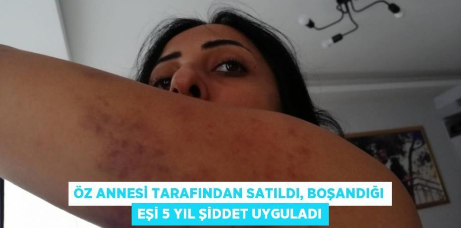 Öz annesi tarafından satıldı, boşandığı eşi 5 yıl şiddet uyguladı