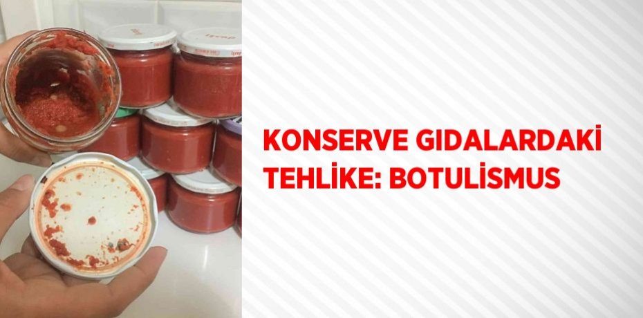 KONSERVE GIDALARDAKİ TEHLİKE: BOTULİSMUS