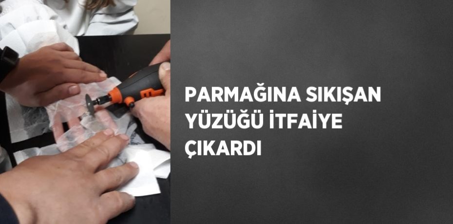 PARMAĞINA SIKIŞAN YÜZÜĞÜ İTFAİYE ÇIKARDI