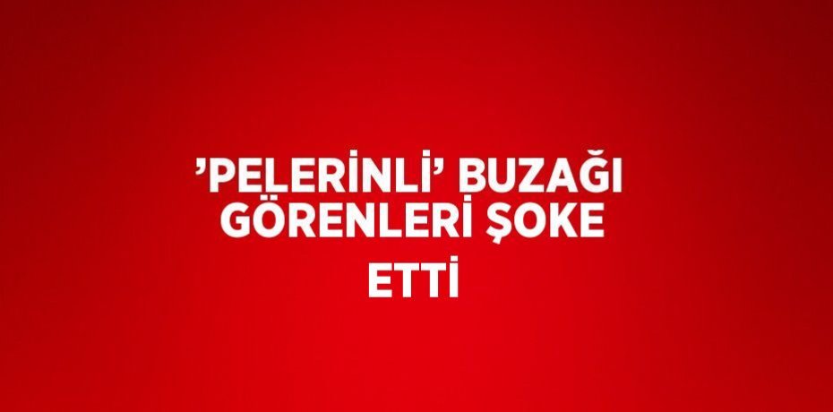 ’PELERİNLİ’ BUZAĞI GÖRENLERİ ŞOKE ETTİ