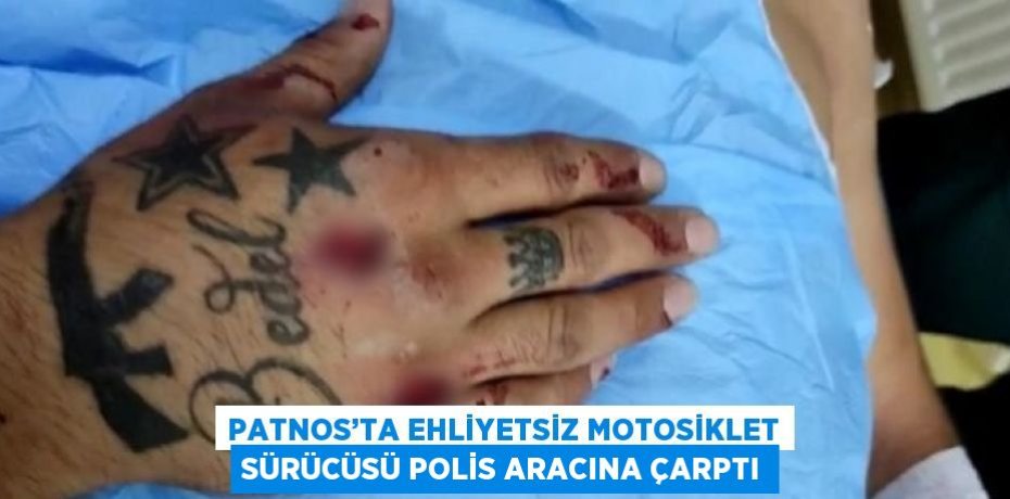 PATNOS’TA EHLİYETSİZ MOTOSİKLET SÜRÜCÜSÜ POLİS ARACINA ÇARPTI