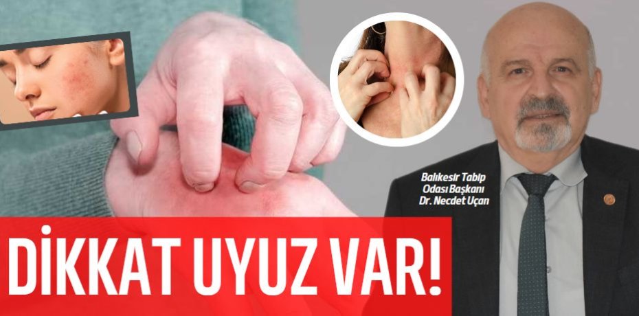 DİKKAT UYUZ VAR!