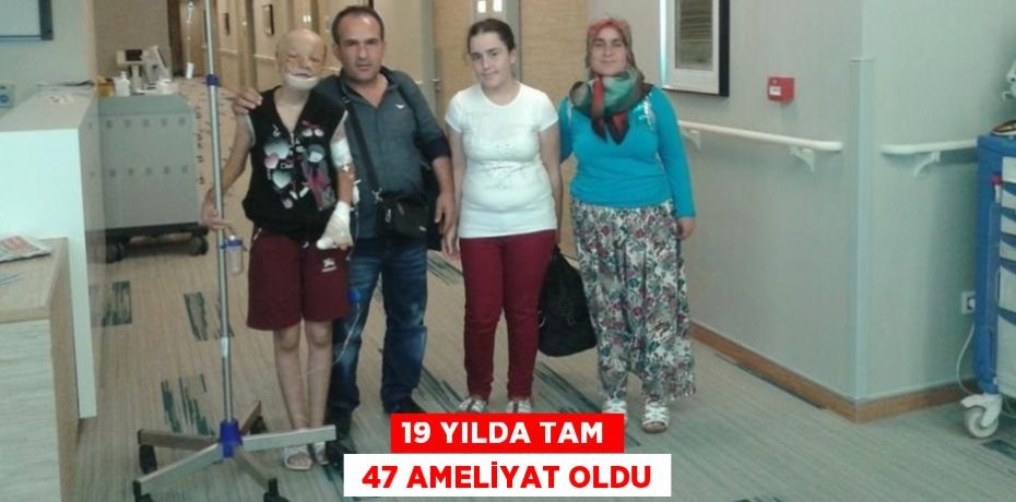 19 YILDA TAM  47 AMELİYAT OLDU