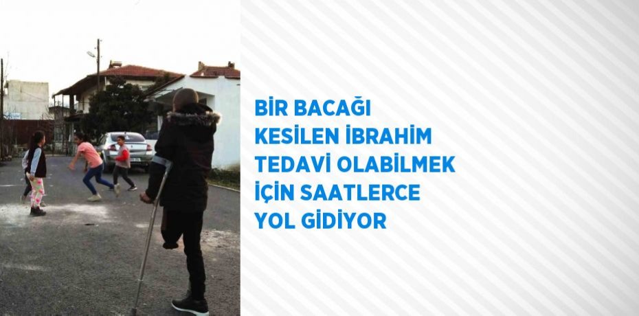 BİR BACAĞI KESİLEN İBRAHİM TEDAVİ OLABİLMEK İÇİN SAATLERCE YOL GİDİYOR