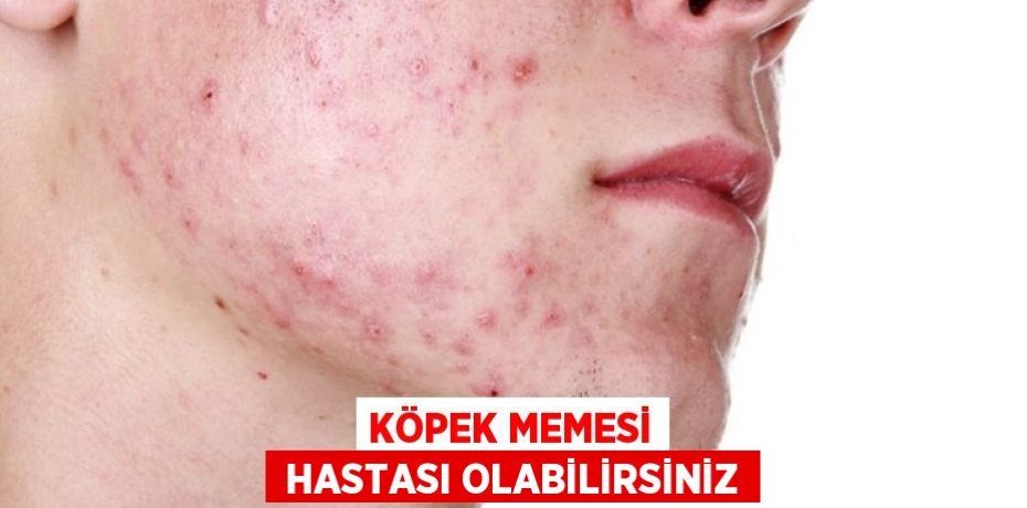 KÖPEK MEMESİ  HASTASI OLABİLİRSİNİZ