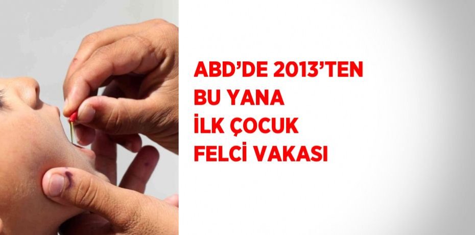 ABD’DE 2013’TEN BU YANA İLK ÇOCUK FELCİ VAKASI