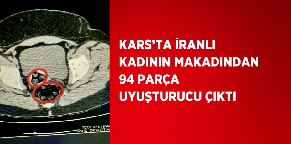 KARS’TA İRANLI KADININ MAKADINDAN 94 PARÇA UYUŞTURUCU ÇIKTI