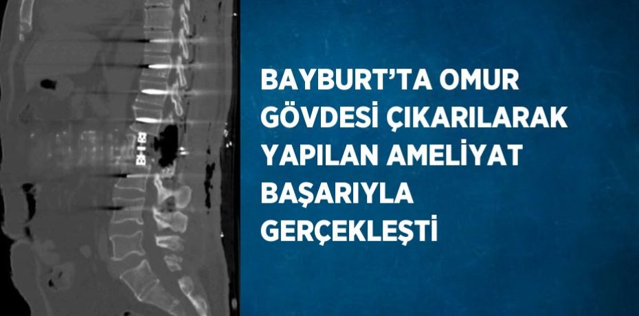 BAYBURT’TA OMUR GÖVDESİ ÇIKARILARAK YAPILAN AMELİYAT BAŞARIYLA GERÇEKLEŞTİ